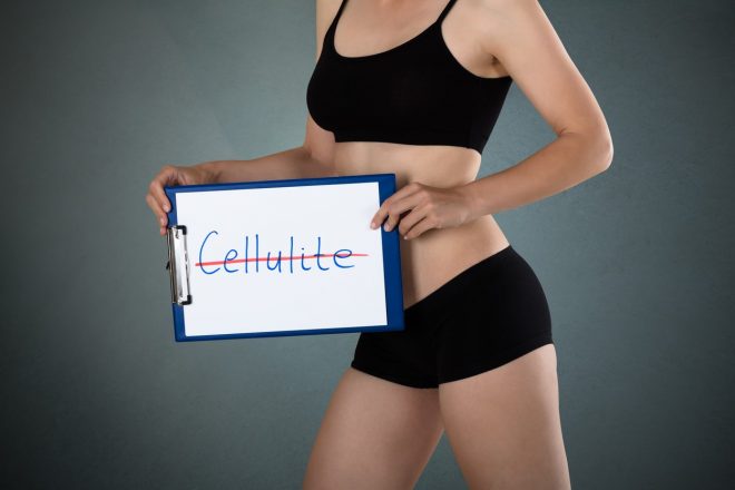 5+trikov%2C+kako+skriti%2C+da+imamo+celulit+%28Foto%3A+Profimedia%29