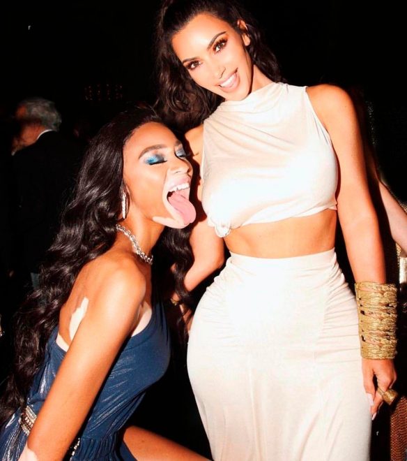 Winnie+Harlow+%28Foto%3A+Profimedia%29