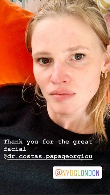 Lara+Stone+%28Foto%3A+Profimedia%29