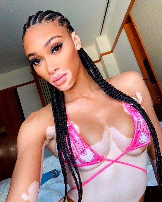 Winnie+Harlow+%28Foto%3A+Profimedia%29