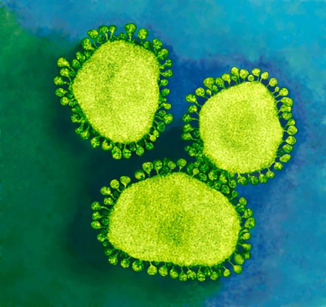 koronavirus+-+biolo%C5%A1ko+oro%C5%BEje%3F+%28Foto%3A+Profimedia%29