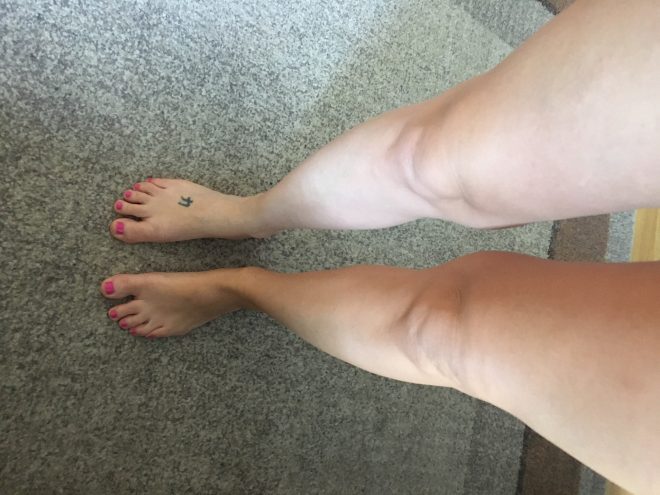 Fotografija+prej+%28desno%29+in+po+%28levo%29+nanosu+najlonk+v+spreju+%28Foto%3A+S.L.%29