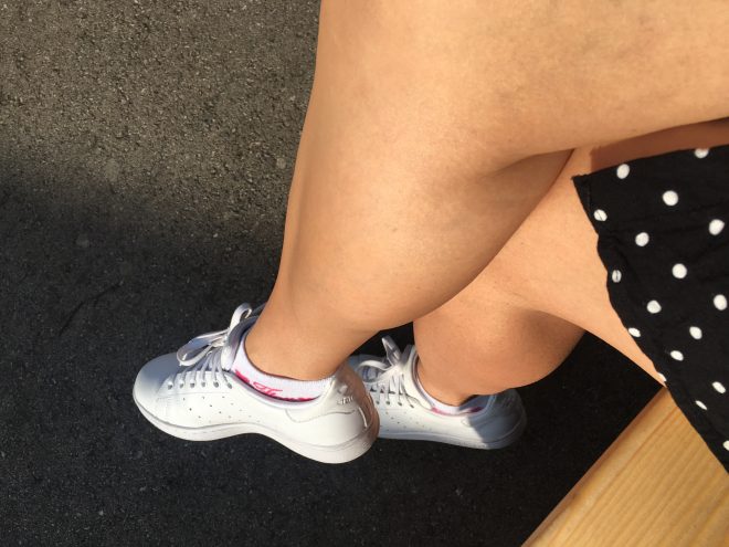 Zagorele+noge+%C5%A1e+pred+poletjem+in+brez+son%C4%8Denja+%28Foto%3A+S.L.%29